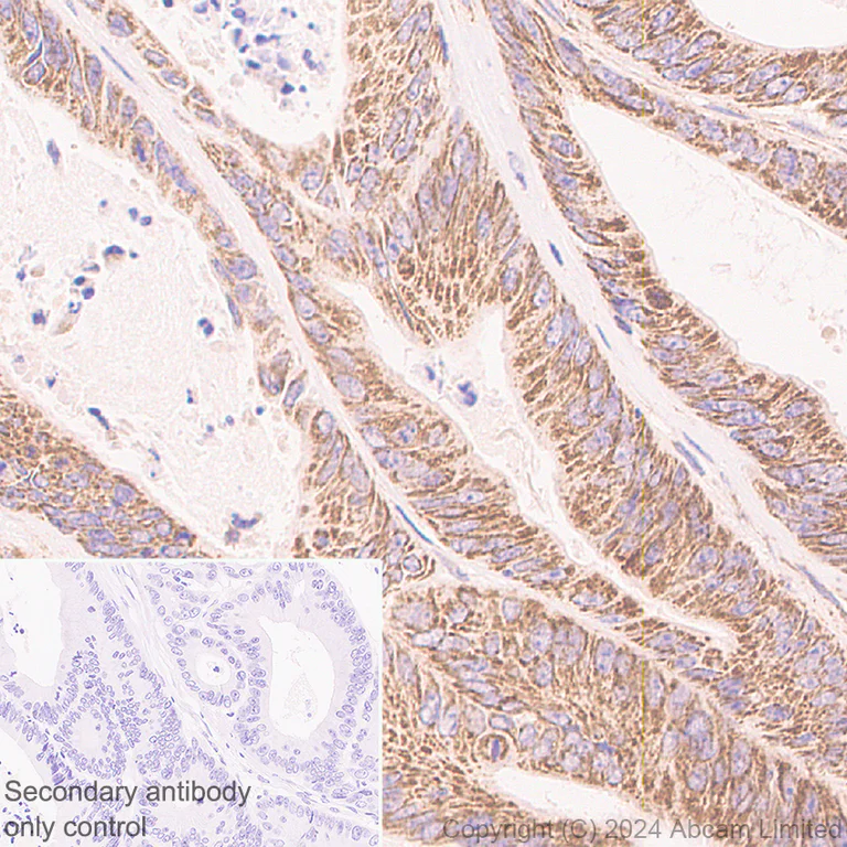 Immunohistochemistry (Formalin/PFA-fixed paraffin-embedded sections) - Anti-MIRO2 antibody [RM2077] (AB322962)
