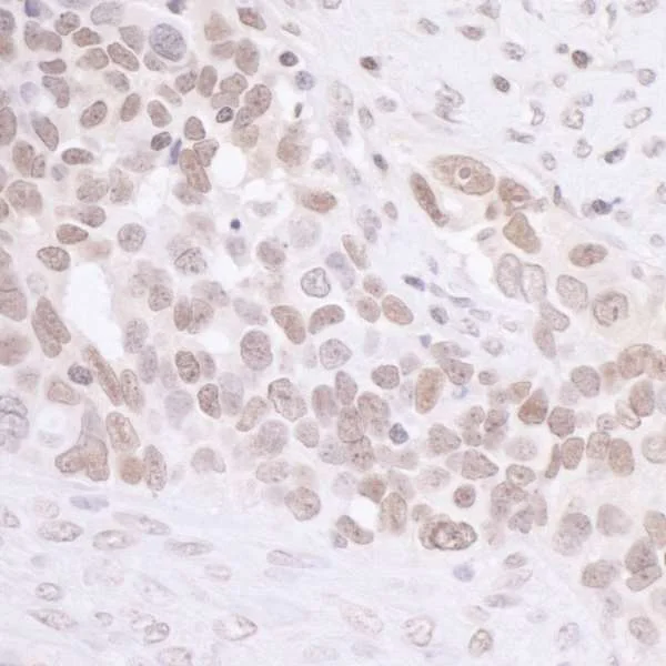 Immunohistochemistry (Formalin/PFA-fixed paraffin-embedded sections) - Anti-MIS12 antibody (AB70843)