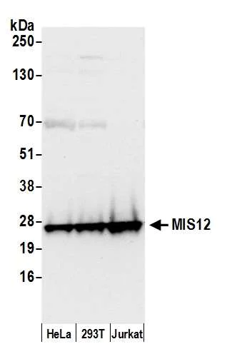 Western blot - Anti-MIS12 antibody (AB70843)