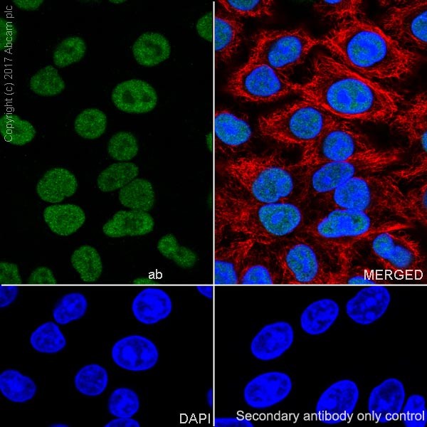 Immunocytochemistry/ Immunofluorescence - Mismatch Repair (MSH6, PMS2, MLH1, MSH2) Antibody Panel - Human (ab252190), expandable thumbnail