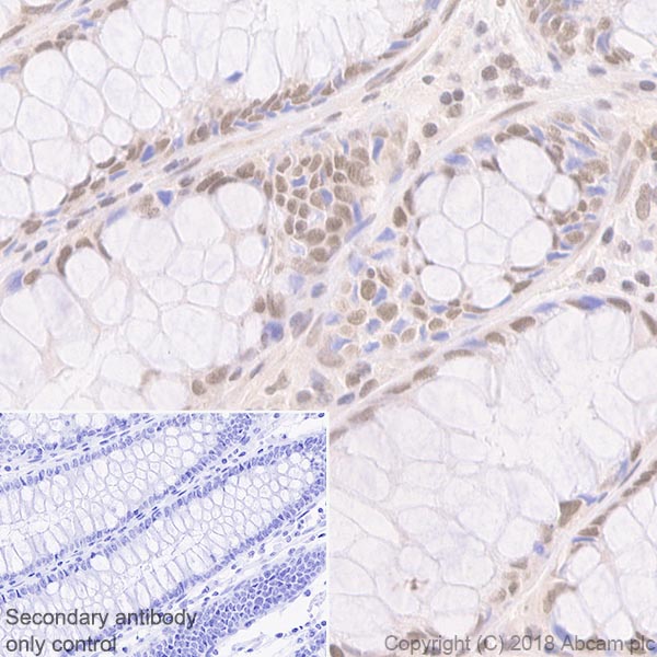 Immunohistochemistry (Formalin/PFA-fixed paraffin-embedded sections) - Mismatch Repair (MSH6, PMS2, MLH1, MSH2) Antibody Panel - Human (ab252190), expandable thumbnail
