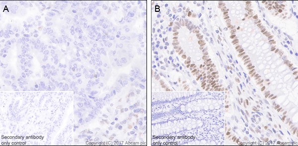 Immunohistochemistry (Formalin/PFA-fixed paraffin-embedded sections) - Mismatch Repair (MSH6, PMS2, MLH1, MSH2) Antibody Panel - Human (AB252190), expandable thumbnail