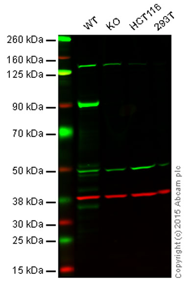 Western blot - Mismatch Repair (MSH6, PMS2, MLH1, MSH2) Antibody Panel - Human (ab252190), expandable thumbnail