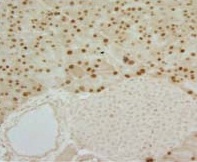 Immunohistochemistry (Formalin/PFA-fixed paraffin-embedded sections) - Anti-MIST-1 antibody [6E8/A12/C11P1] - C-terminal (AB110919)