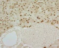 Immunohistochemistry (Formalin/PFA-fixed paraffin-embedded sections) - Anti-MIST-1 antibody [6E8/A12/C11P1] - C-terminal (AB110919)