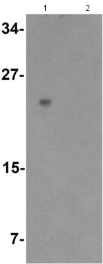 Western blot - Anti-MIST-1 antibody (AB180889)