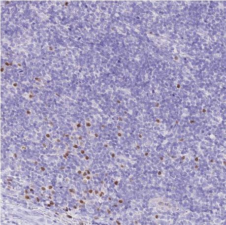 Immunohistochemistry (Formalin/PFA-fixed paraffin-embedded sections) - Anti-MIST-1 antibody (AB187978), expandable thumbnail