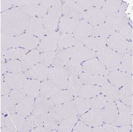 Immunohistochemistry (Formalin/PFA-fixed paraffin-embedded sections) - Anti-MIST-1 antibody (AB187978), expandable thumbnail
