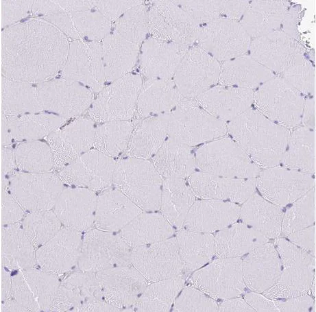 Immunohistochemistry (Formalin/PFA-fixed paraffin-embedded sections) - Anti-MIST-1 antibody (AB187978)