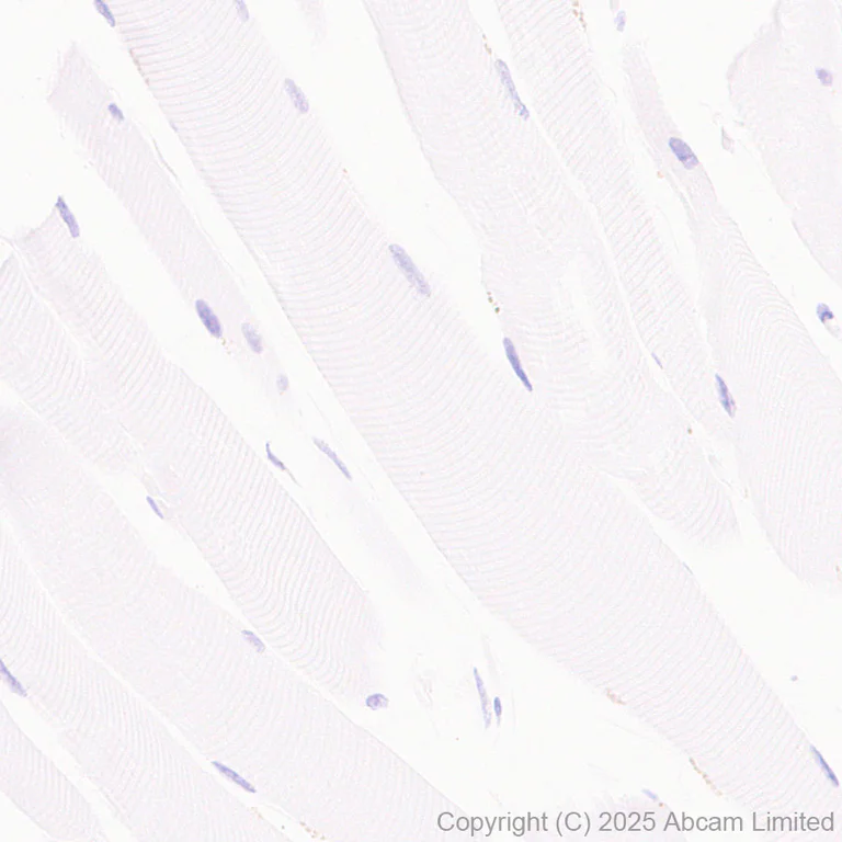 Immunohistochemistry (Formalin/PFA-fixed paraffin-embedded sections) - Anti-MIST-1 antibody [EPR29652-63] (AB324434)