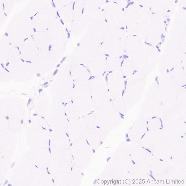 Immunohistochemistry (Formalin/PFA-fixed paraffin-embedded sections) - Anti-MIST-1 antibody [EPR29652-63] (AB324434)