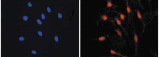 Immunocytochemistry/ Immunofluorescence - Anti-MiTF antibody (AB122982), expandable thumbnail
