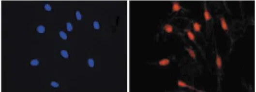 Immunocytochemistry/ Immunofluorescence - Anti-MiTF antibody (AB122982)
