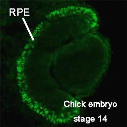 Immunohistochemistry (Frozen sections) - Anti-MiTF antibody (AB122982)