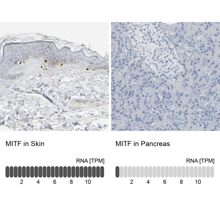 Immunohistochemistry (Formalin/PFA-fixed paraffin-embedded sections) - Anti-MITF Antibody (AB327178)