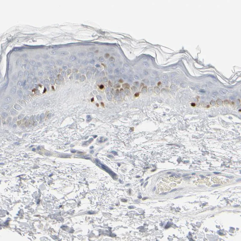 Immunohistochemistry (Formalin/PFA-fixed paraffin-embedded sections) - Anti-MITF Antibody (AB327178)