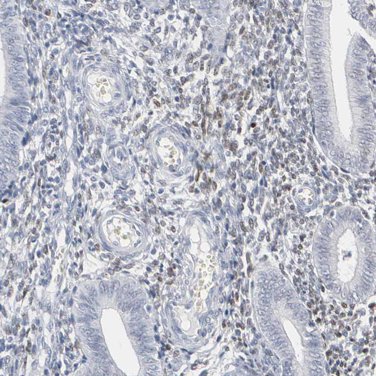 Immunohistochemistry (Formalin/PFA-fixed paraffin-embedded sections) - Anti-MITF Antibody (AB327178)