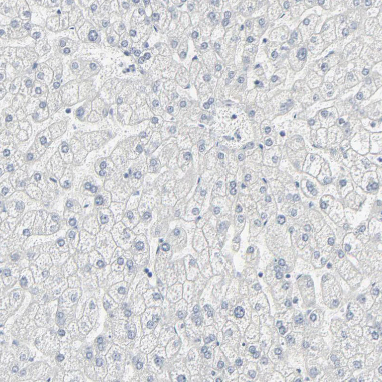 Immunohistochemistry (Formalin/PFA-fixed paraffin-embedded sections) - Anti-MITF Antibody (AB327178)