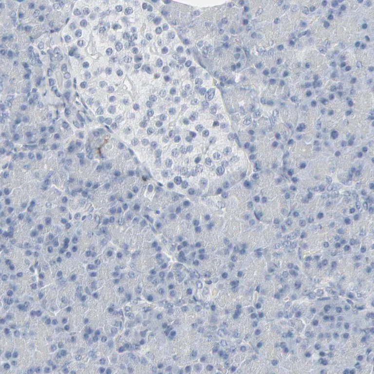 Immunohistochemistry (Formalin/PFA-fixed paraffin-embedded sections) - Anti-MITF Antibody (AB327178)