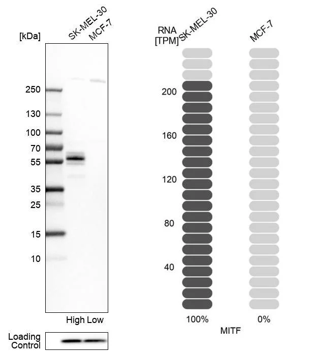 Western blot - Anti-MITF Antibody (AB327178)