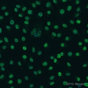 Immunocytochemistry - Anti-MiTF antibody [D5] (AB3201), expandable thumbnail