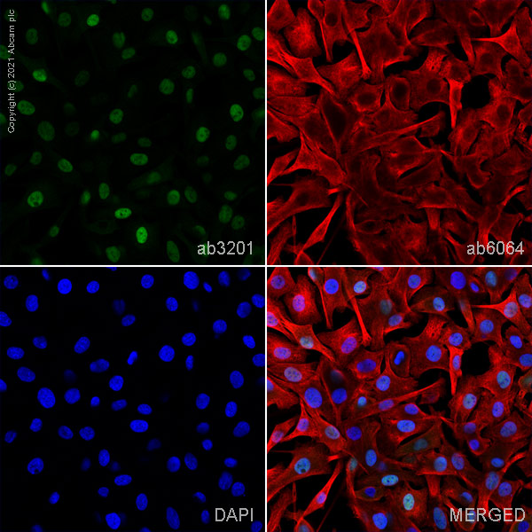 Immunocytochemistry - Anti-MiTF antibody [D5] (AB3201), expandable thumbnail