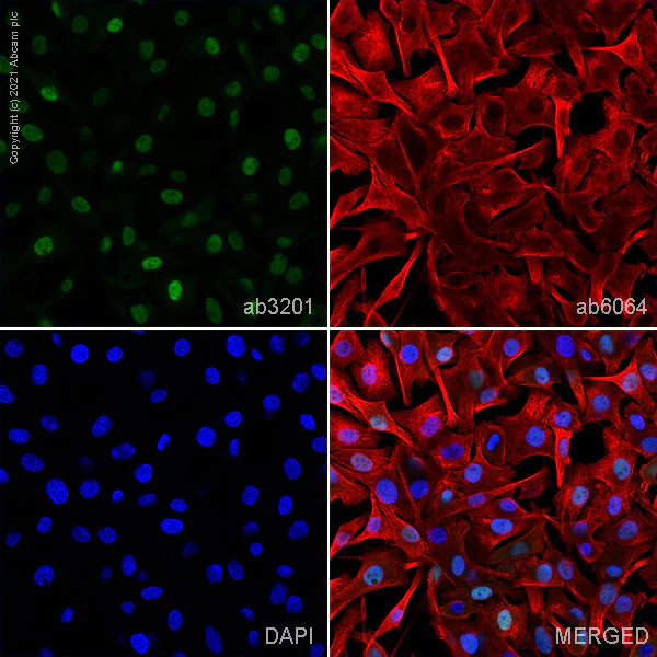 Immunocytochemistry - Anti-MiTF antibody [D5] (AB3201)