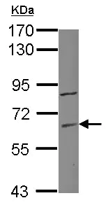 Western blot - Anti-MiTF antibody [D5] - BSA and Azide free (AB182842)