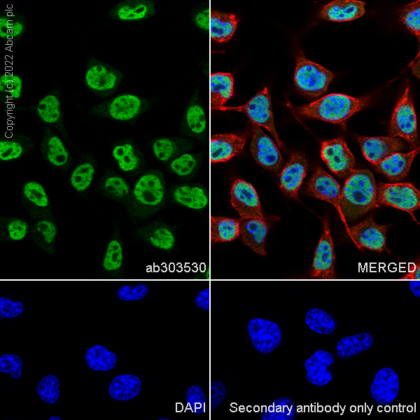 Immunocytochemistry/ Immunofluorescence - Anti-MiTF antibody [EPR26363-10] (AB303530), expandable thumbnail