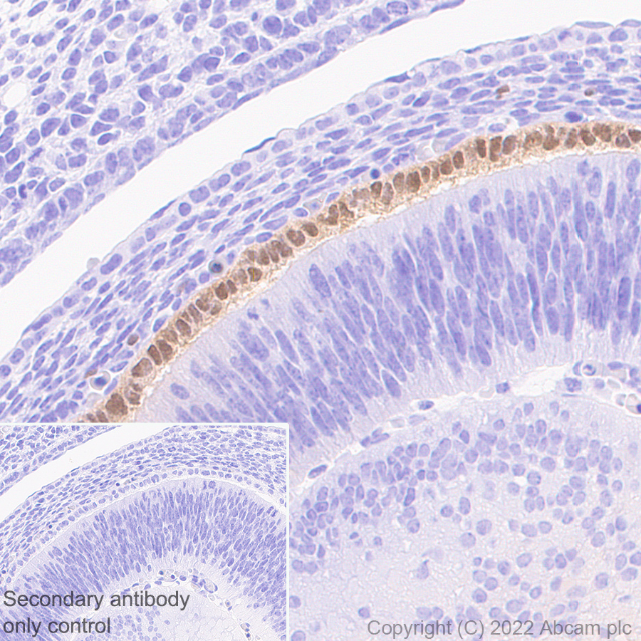 Immunohistochemistry (Formalin/PFA-fixed paraffin-embedded sections) - Anti-MiTF antibody [EPR26363-10] (ab303530), expandable thumbnail