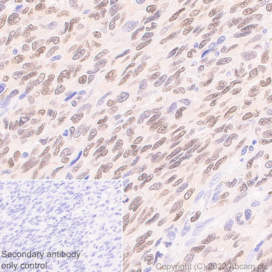 Immunohistochemistry (Formalin/PFA-fixed paraffin-embedded sections) - Anti-MiTF antibody [EPR26363-10] (ab303530), expandable thumbnail