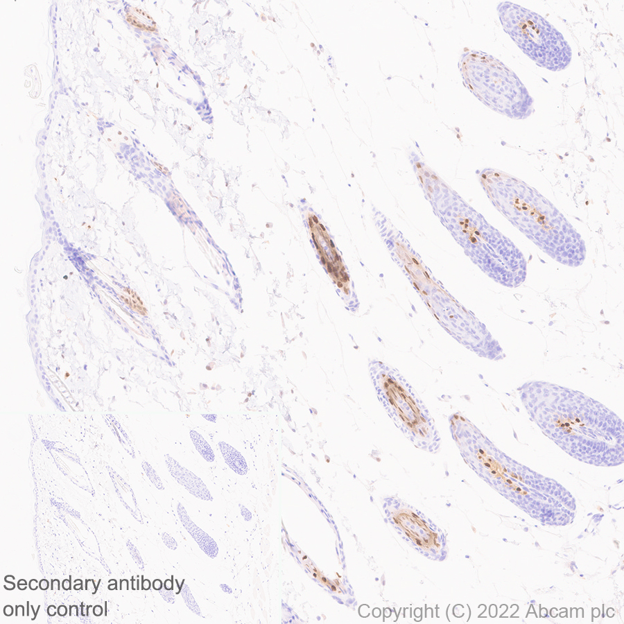 Immunohistochemistry (Formalin/PFA-fixed paraffin-embedded sections) - Anti-MiTF antibody [EPR26363-10] (ab303530), expandable thumbnail