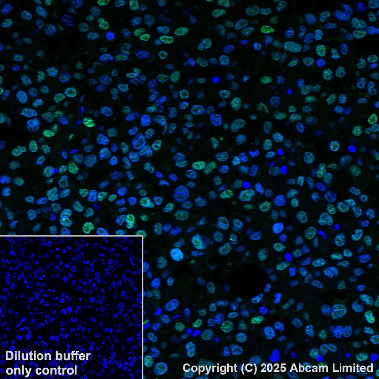 Immunohistochemistry (Formalin/PFA-fixed paraffin-embedded sections) - Anti-MiTF antibody [EPR26363-10] (AB303530)