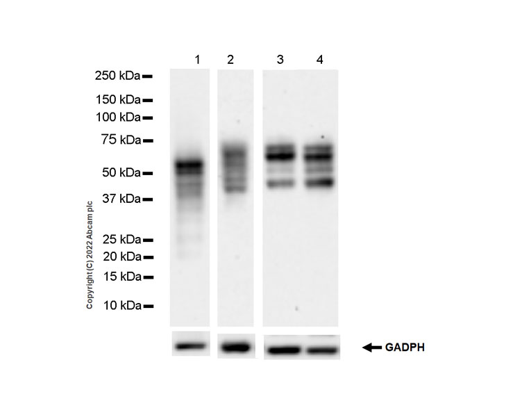 Western blot - Anti-MiTF antibody [EPR26363-10] (AB303530), expandable thumbnail