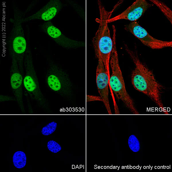 Immunocytochemistry/ Immunofluorescence - Anti-MiTF antibody [EPR26363-10] - BSA and Azide free (AB303531)