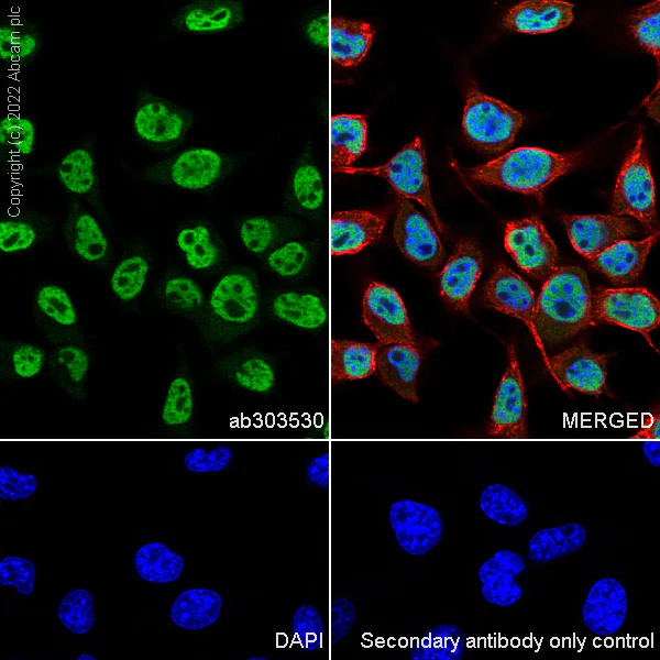 Immunocytochemistry/ Immunofluorescence - Anti-MiTF antibody [EPR26363-10] - BSA and Azide free (AB303531)