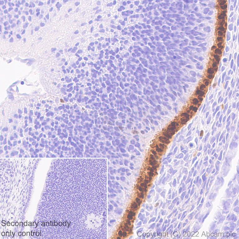 Immunohistochemistry (Formalin/PFA-fixed paraffin-embedded sections) - Anti-MiTF antibody [EPR26363-10] - BSA and Azide free (AB303531)