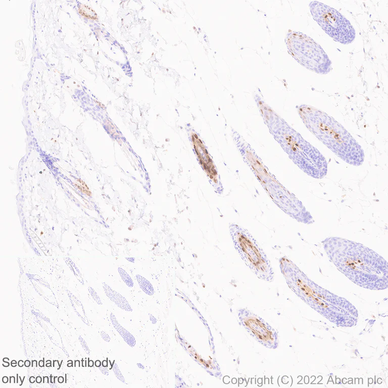 Immunohistochemistry (Formalin/PFA-fixed paraffin-embedded sections) - Anti-MiTF antibody [EPR26363-10] - BSA and Azide free (AB303531)