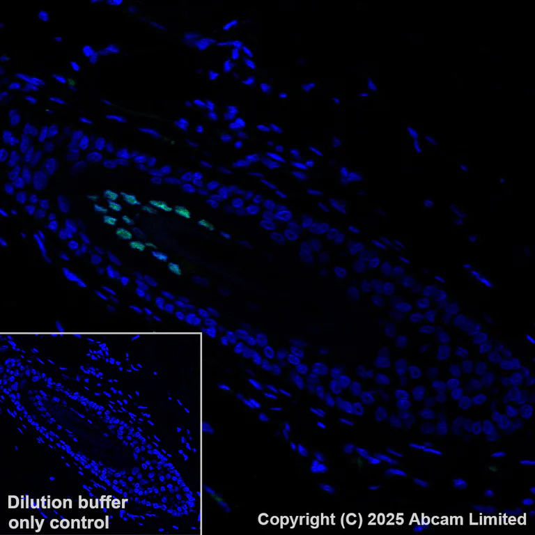 Immunohistochemistry (Formalin/PFA-fixed paraffin-embedded sections) - Anti-MiTF antibody [EPR26363-10] - BSA and Azide free (AB303531)