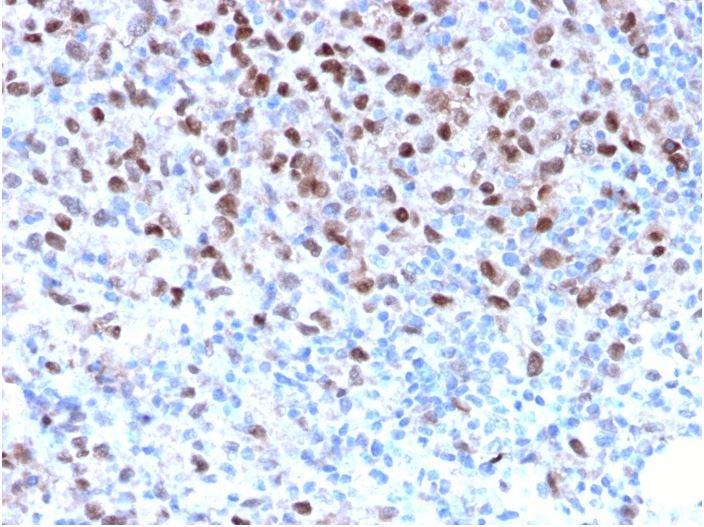 Immunohistochemistry (Formalin/PFA-fixed paraffin-embedded sections) - Anti-MiTF antibody [MITF/2987R] (AB270262)
