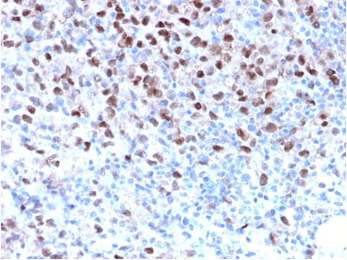 Immunohistochemistry (Formalin/PFA-fixed paraffin-embedded sections) - Anti-MiTF antibody [MITF/2987R] (AB270262)