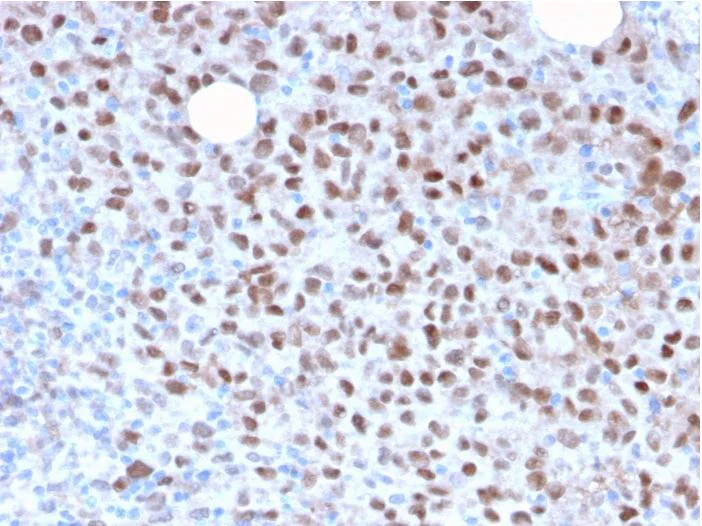 Immunohistochemistry (Formalin/PFA-fixed paraffin-embedded sections) - Anti-MiTF antibody [MITF/2987R] (AB270262)