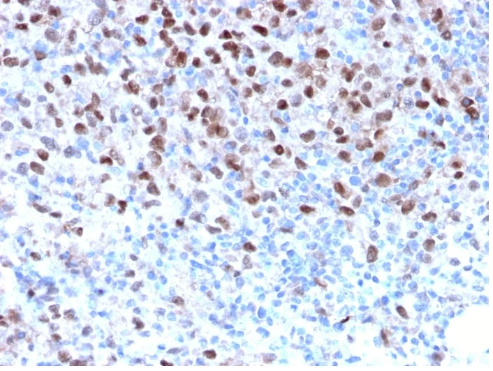 Immunohistochemistry (Formalin/PFA-fixed paraffin-embedded sections) - Anti-MiTF antibody [MITF/2987R] - BSA and Azide free (AB270293)