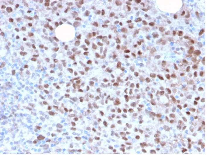 Immunohistochemistry (Formalin/PFA-fixed paraffin-embedded sections) - Anti-MiTF antibody [MITF/2987R] - BSA and Azide free (AB270293)