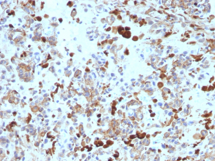 Immunohistochemistry (Formalin/PFA-fixed paraffin-embedded sections) - Anti-MiTF antibody [MITF/915] (AB215845)