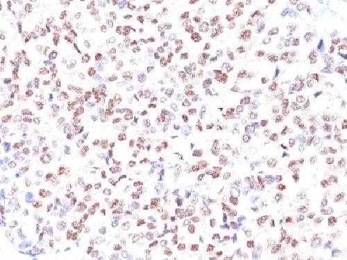 Immunohistochemistry (Formalin/PFA-fixed paraffin-embedded sections) - Anti-MiTF antibody [MITF/915] (AB215845)