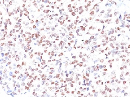 Immunohistochemistry (Formalin/PFA-fixed paraffin-embedded sections) - Anti-MiTF antibody [MITF/915] - BSA and Azide free (AB212611)