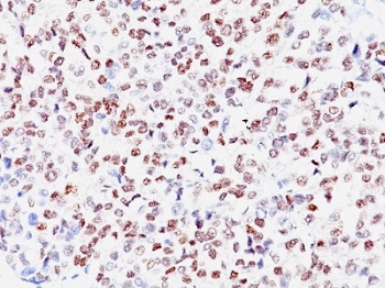 Immunohistochemistry (Formalin/PFA-fixed paraffin-embedded sections) - Anti-MiTF antibody [SPM290] (AB233928), expandable thumbnail
