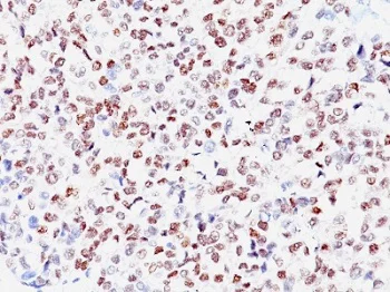 Immunohistochemistry (Formalin/PFA-fixed paraffin-embedded sections) - Anti-MiTF antibody [SPM290] (AB233928)