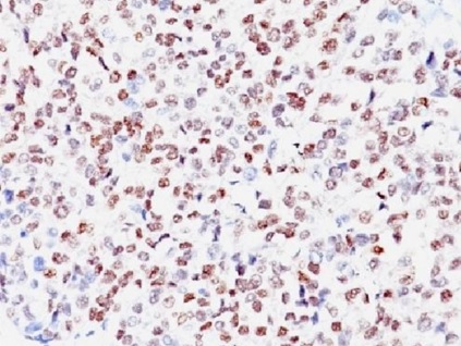 Immunohistochemistry (Formalin/PFA-fixed paraffin-embedded sections) - Anti-MiTF antibody [SPM290] - BSA and Azide free (AB212610)